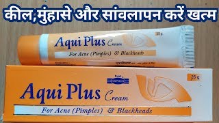 Aqui Plus cream for Acne and Blackheadsreview in hindi [upl. by Turoff]