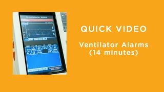 Ventilator Alarms [upl. by Ezekiel]