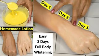 I applied👆this Skin Whitening Lotion On Dark HandsIn 3 Days Dark Dull Skin Got Fair White amp Glowing [upl. by Accber476]