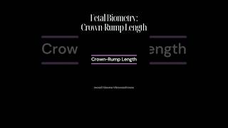 CrownRump Length CRL [upl. by Lhok]