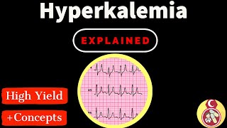 Hyperkalemia  Causes  signs  management شرح بالعربي [upl. by Noyar]