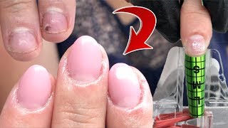 NAGELBEISSER MODELLAGE vorhernachher 😳 Verlängerung über Schablone [upl. by Rehttam]