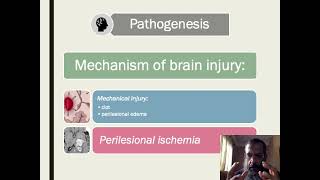 intracerebral hemorrhage [upl. by Erodroeht]