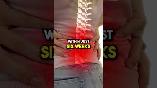 Can You Heal a Herniated Disc backpainrelief bobandbrad herniateddisc painrelief healthtips [upl. by Somerset495]