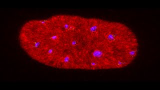 Heterochromatin movement after inhibition of actin polymerisation [upl. by Lesoj]