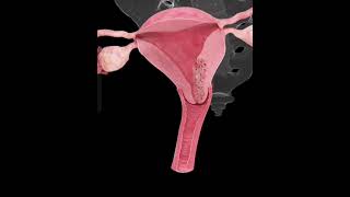 Understanding The Endometrial Cancerwomenhealtbiologyscience viralshorts [upl. by Josefa958]