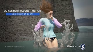 3D Animation Portrays Spinal Compression Fracture Injury [upl. by Aram577]