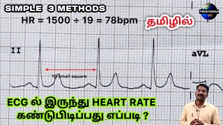 HEART RATE IN ECG TAMIL  Calculate HR in arrhythmia ECG  6 sec method  PS TAMIL [upl. by Warfourd]