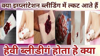 Kya Implantation bleeding me clots aate hai।Heavy Bleeding hoti hai।Implantation Bleeding Vs Periods [upl. by Julio]