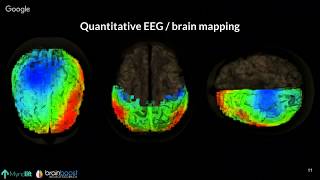 Fundamentals of Neurofeedback Webinar [upl. by Navets285]