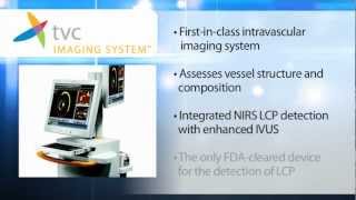 Introduction to the TVC Imaging System™ [upl. by Wendye487]