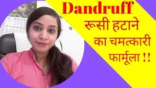 Dandruff  dandruff homeopathic medicine  dandruff removal amp dandruff treatment in homeopathy [upl. by Isadore884]