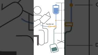 Peritoneal dialysis [upl. by Otnas]