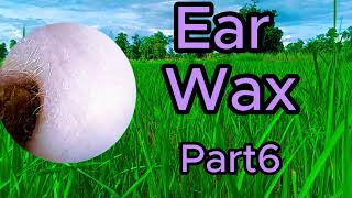 ear wax removal asmr [upl. by Erma859]