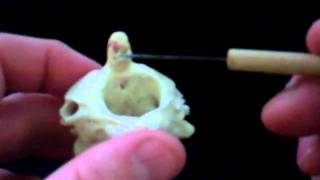 Vertebral Column Bone VideoMP4 [upl. by Olathe209]