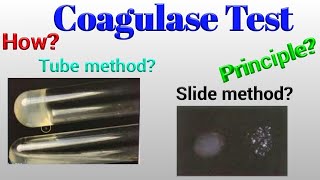 Coagulase Test [upl. by Deckert759]