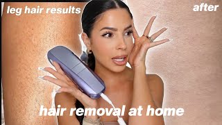 I TRIED LASER HAIR REMOVAL AT HOME this is what happened [upl. by Bessie563]