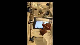 Impella Setup Cath Lab Inservice [upl. by Airrat305]