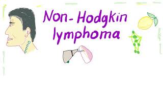 NonHodgkins lymphoma NHL Bcell and Tcell  Aggressive and Indolent [upl. by Itch]