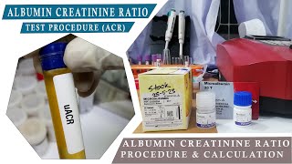 ALBUMIN CREATININE RATION ACR How to Microalbumin Test amp Urine Creatinine Test Procedure [upl. by Enyedy]