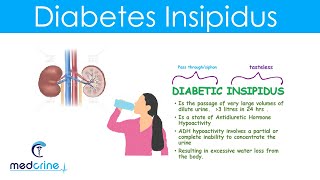 Diabetes Insipidus DI Causes Symptoms Diagnosis and treatment [upl. by Eliath]