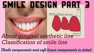 SMILE DESIGN lecture part 3Discussing the tooth and the soft tissue components in detail [upl. by Reedy]