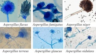 o fungo ASPERGILLUS mata milhares de pássaros todos os anos um tratamento natural para aspergilose [upl. by Ariana]