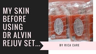 Dr Alvin Skin Rejuvenating Set My Skin before using the product [upl. by Drofyar]