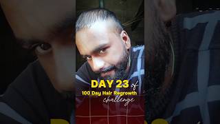 Day 23  100 day hair regrowth challenge ytshorts [upl. by Firman]