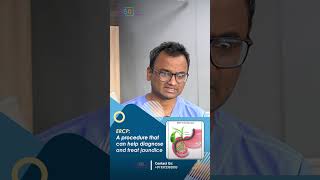 ERCP or PTBD Which is More Effective for Jaundice in Bile Duct Cancer  Dr Praveen Kammar [upl. by Knut628]