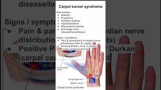 Carpal tunnel syndrome [upl. by King69]