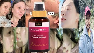 Twachaa Oil Control Astringent Toner  Honest Review [upl. by Noiramaj]