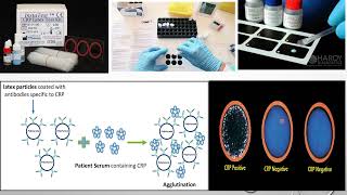 Serology part 5th stage Lecture 2CRP amp RF slide agglutination test Part 1 [upl. by Animrelliug]