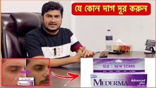 Mederma Advanced Scar Removal Gel  অপারেশন এর দাগ দ্রুতগতিতে দূর করে যে ক্রিম  Scar Removal Cream [upl. by Sido]