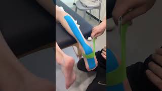 Use kinesiology tape to stabilize the ankle Achilles tendon to reduce running injuries [upl. by Pallua294]