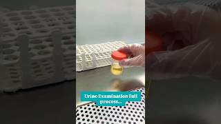 Urine exam fluid process [upl. by Abana865]