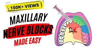 Maxillary Nerve Block Anesthesia For Dental Procedures [upl. by Levram387]