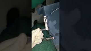 Dingman Retractor cleft lip cleft palate surgery [upl. by Jerry]