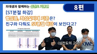 의대생과 함께하는 심전도 기본편 I 8편ST분절 하강협심증좌심실비대 기준은 친구와 다퉈도 ST분절 하강이 보인다고 [upl. by Werd765]