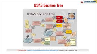 Lecture 5  International Caries Detection and Assessment System ICDAS – An Overview  SRIHER [upl. by Horst]