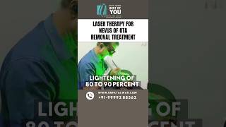 Laser Therapy for Nevus of OTA Removal Treatment  Nevus of OTA Treatment in Delhi  Dr PK Talwar [upl. by Esineg298]