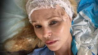 Christie Brinkley Reveals She Has Skin Cancer [upl. by Llennaj]