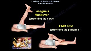 Lesions Of The Sciatic Nerve amp Its Branches  Everything You Need To Know  Dr Nabil Ebraheim [upl. by Idnat]