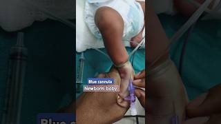 Blue colour cannula Fixed cannula cannulation injection [upl. by Annairam759]