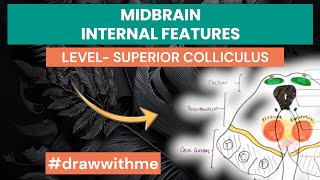 Midbrain Cross Sectional Anatomy  Internal features  level of Superior Colliculus [upl. by Shu]