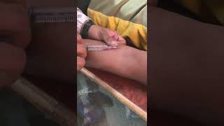 Iv Injection lagane Ka sahi tarika ll new video for injection ll 2024 ll doctor nursing trending [upl. by Sivrep]