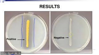 DNase test principle procedure results [upl. by Sauls22]