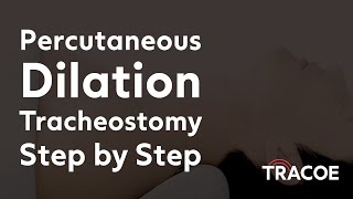 Percutaneous Dilation Tracheostomy Procedure Explained Step by Step [upl. by Northrup]