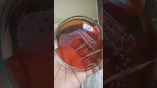 Bacterial colonies  culture media  bacterial growth on agar plates  how to grow bacteria biology [upl. by Atiekram]