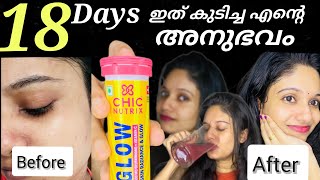 സിനിമനടി ആവാൻ ശ്രമിച്ച എന്റെ അവസ്ഥ  CHICNUTRIX Glutathione Review Malayalam  My experience [upl. by Suidualc12]